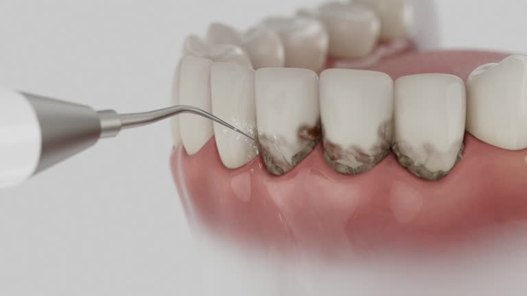 Reliable Dental Implants contractor in Clever, MO by Smile Center Dentistry